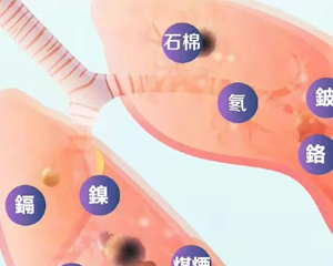 国际肺癌日，我国是肺癌发病率最高的国家之一